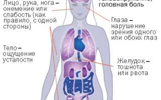 Признаки инсульта: предвестники, первые проявления, симптомы и их классы, отличия ишемического и геморрагического