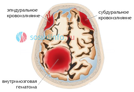 4468486468