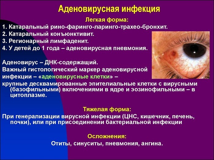 Аденовирусная инфекция