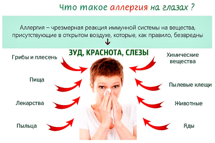 Аллергия на глазах