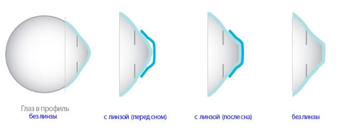 Действие линз