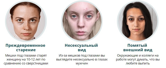 Черные круги под глазами