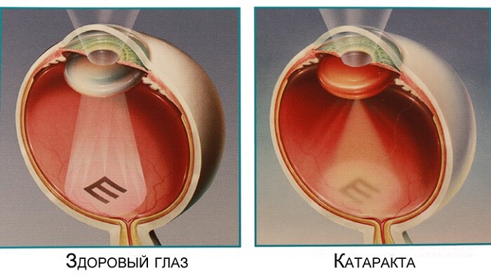 Четкость изображения