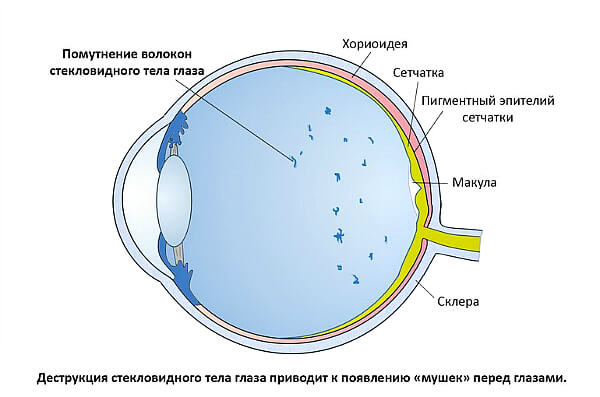 Деструкция глазного яблока