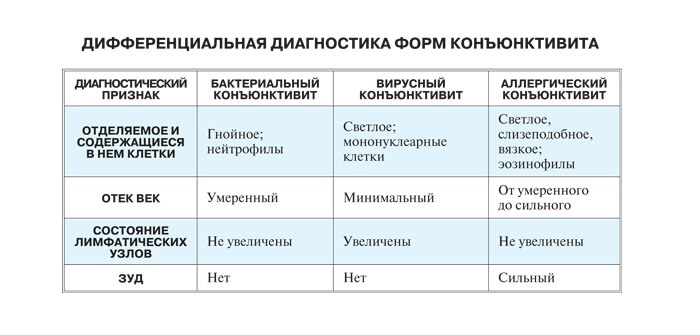 Диагностика конъюнктивита