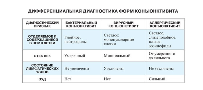 Диагностика конъюнктивита
