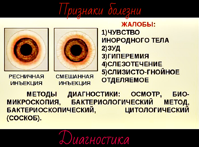 Диагностика заболевания