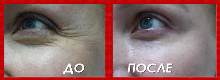 Эффект после крема