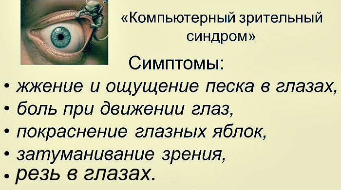 Компьютерный зрительный синдром