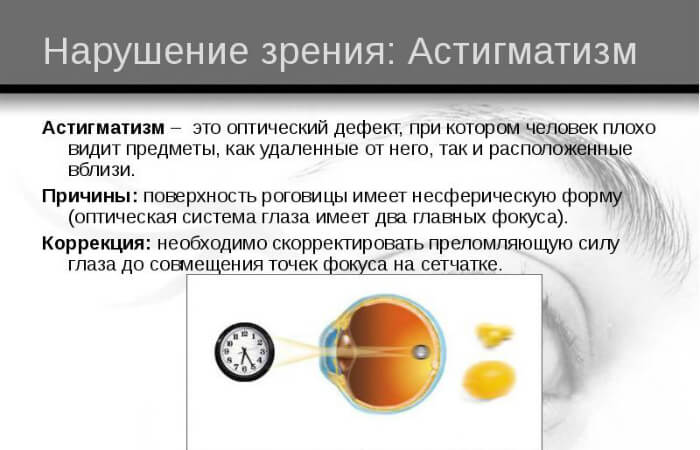 Коррекция дефекта