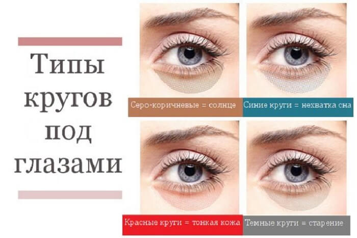 Круги под глазами