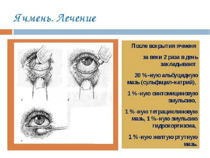 Лечение данного недуга