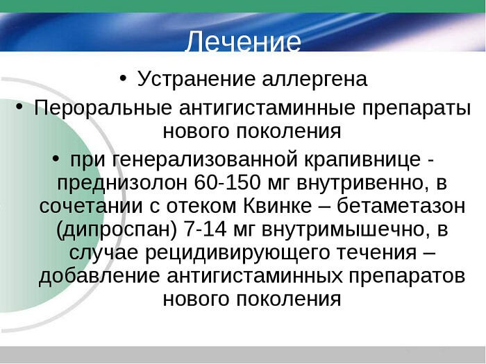 Лечение отека Квинке