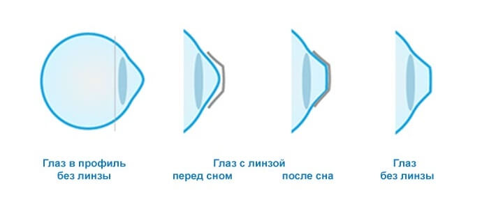 Изменения глаза