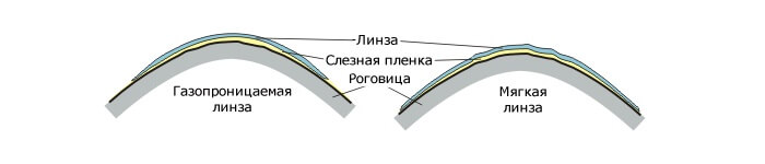 Различия линз