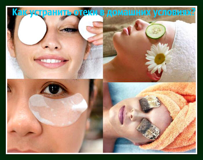 Народные средства от отеков