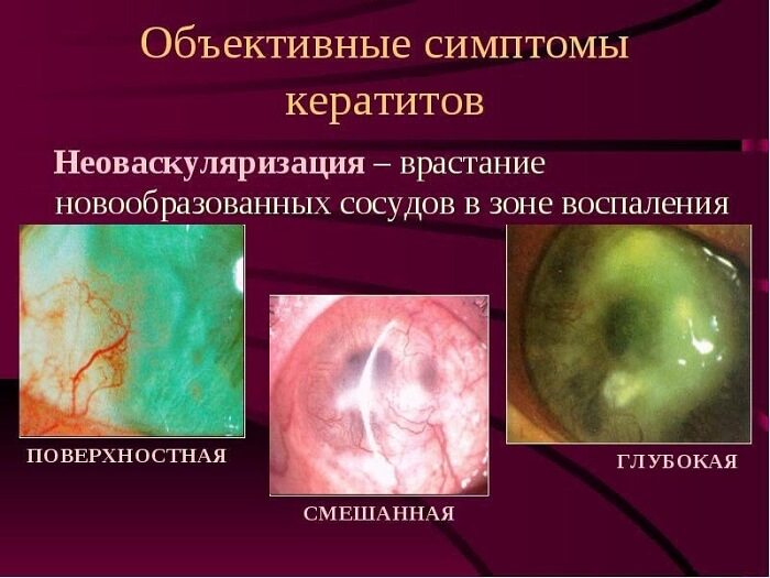 Объективные симптомы