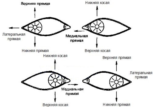 Диплопия при параличе отдельных мышц глаза