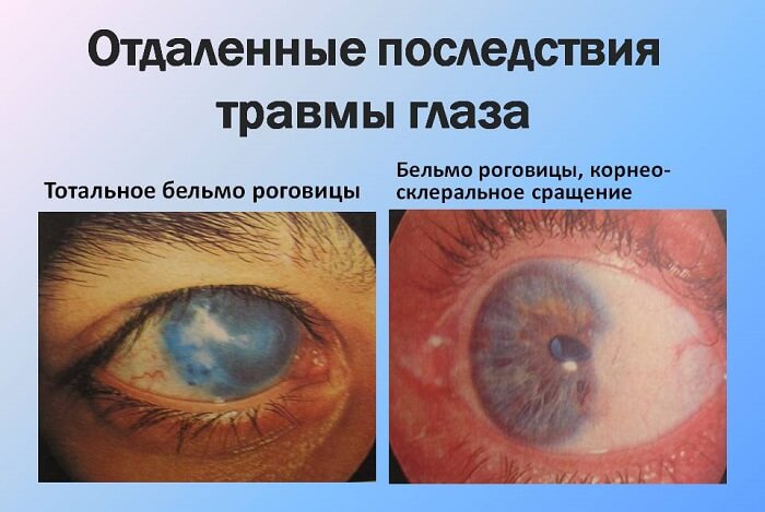 Последствия травмы