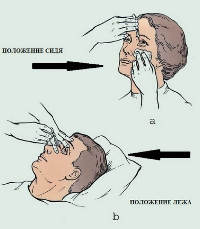 Правильное закапывание капель