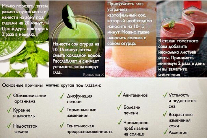 Причины кругов под глазами