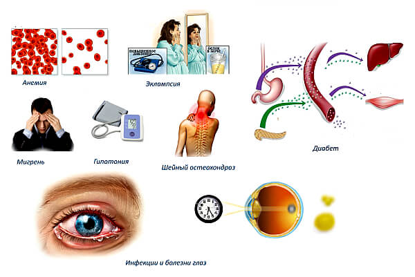 Причины появления мушек