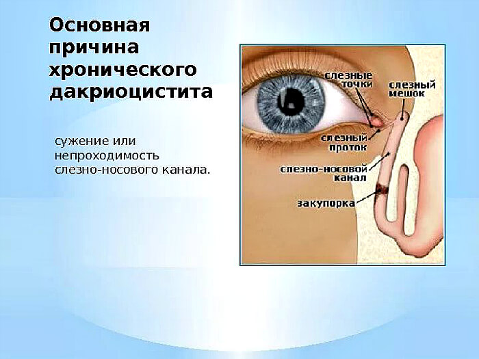 Причины развития заболевания