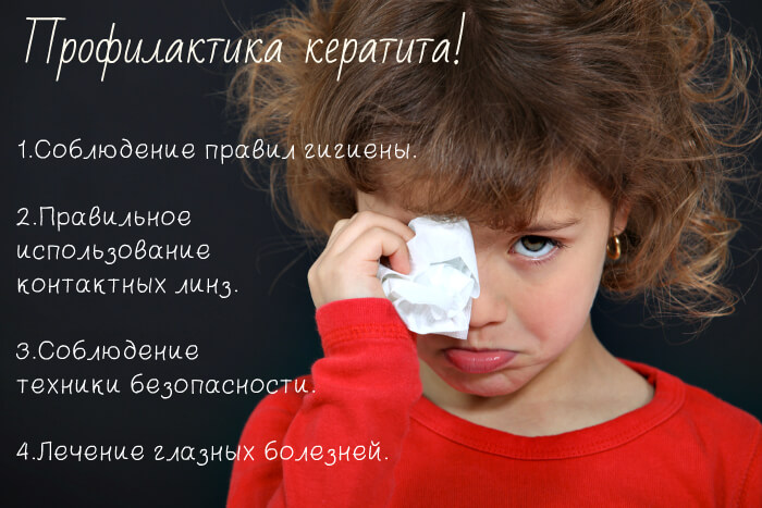 Профилактика кератита