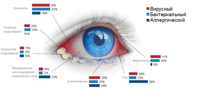 Проявление конъюнктивита человека