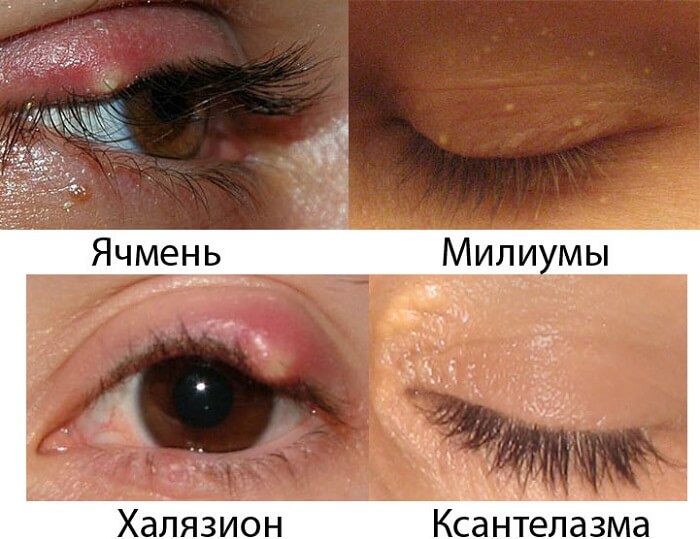 Различия другими заболеваниями