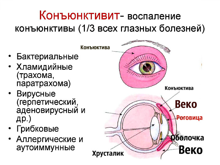 Разновидности воспаления