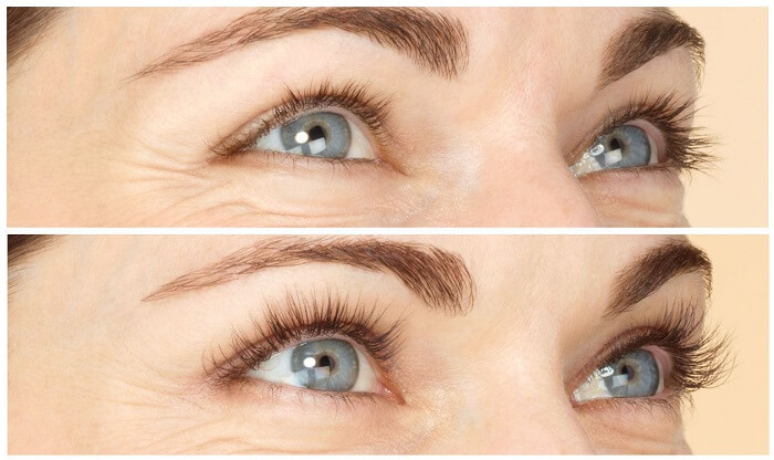 Результат использования масла