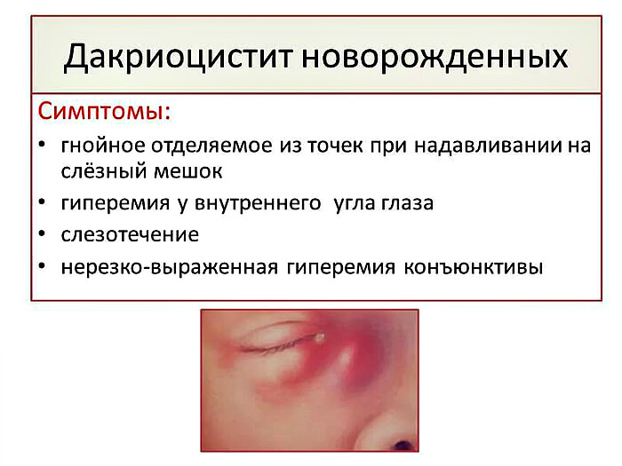 Симптоматика заболевания