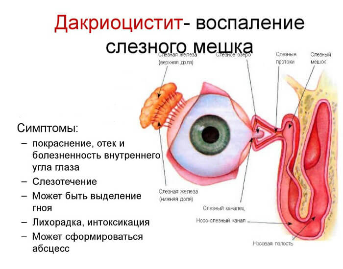 Симптомы воспаления канала
