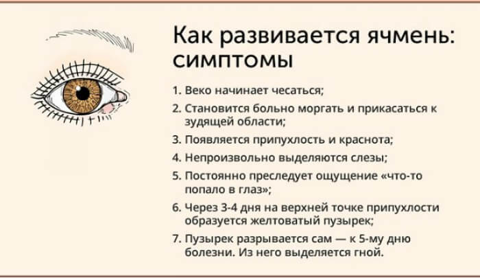 Симптомы ячменя