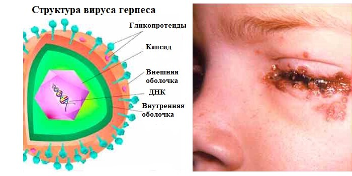 Структура герпеса