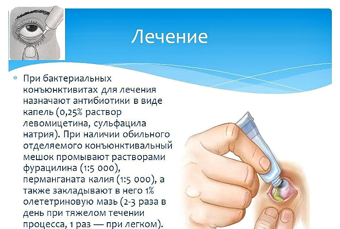 Терапия заболевания