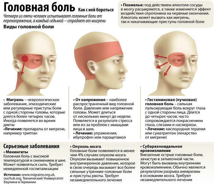 Виды головной боли