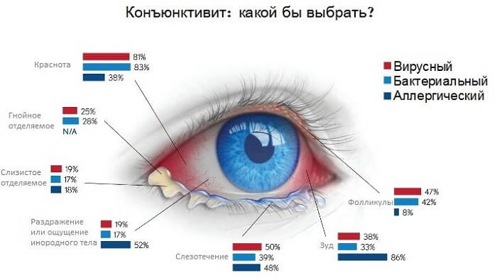 Вирусный, аллергический, бактериальный конъюнктивит