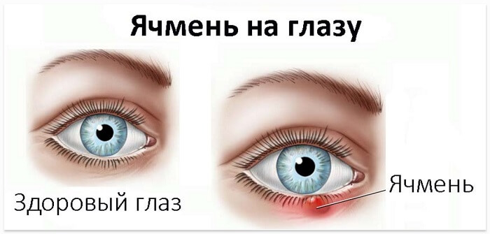 Как выглядит писяк