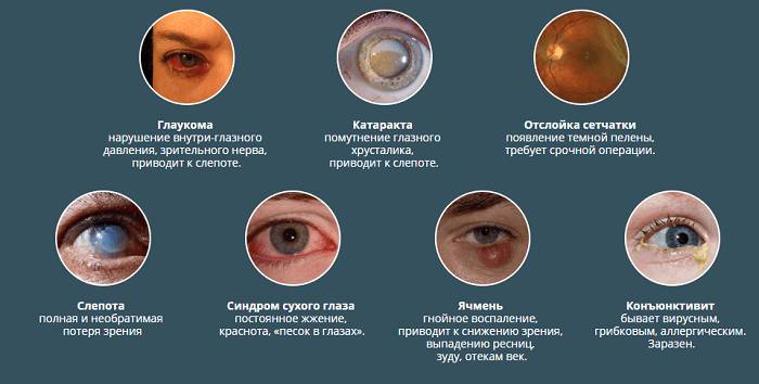 Заболевания глаз