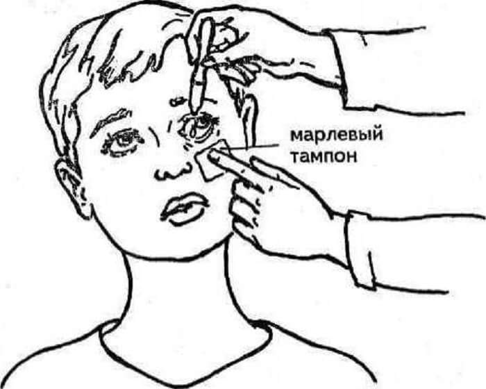 Закапывание ребенку